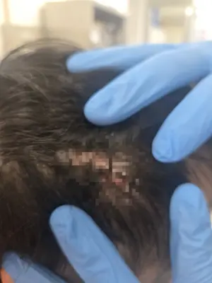 안성 자립시설서 ‘장애인 폭행’… “수개월 전부터 멍”