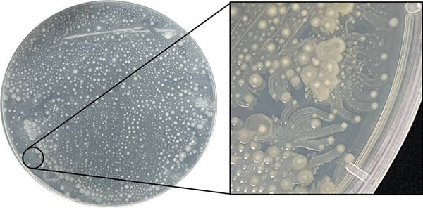 잠재적 병원성 균주로 확인된 미생물의 고체 배양 모습. /극지연구소 제공