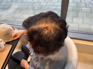 “산책중 공에 맞아… 골프장, 찾아가도 모른 척”