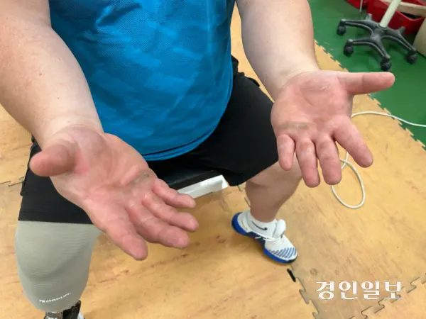 7일 오전 인천시 장애인역도팀 훈련장에서 만난 전나라수 선수의 손에 굳은 살이 박혀 있다. 2025.11.7/백효은기자100@kyeongin.com