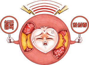 심장이 보낸 신호, ‘S’top ‘O’r ‘S’low