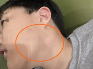 [단독] “학생 목조르고 가위로 위협” 초등교사 아동학대 송치… 교사 혐의부인